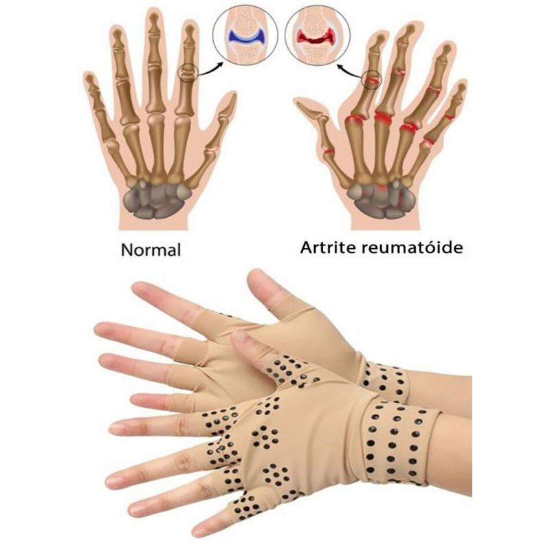 Luva Magnética P/ Artrite, Tendinite, Reumatoide, Túnel de Corpo, L.E.R